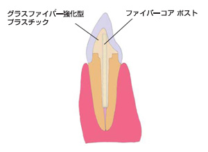 ファイバーコア