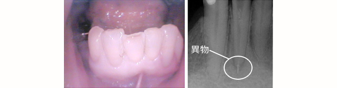 症例